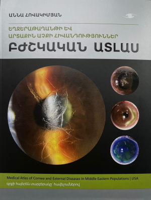 Եղջերաթաղանթի և արտաքին աչքի հիվանդություններ․ բժշկական ատլաս